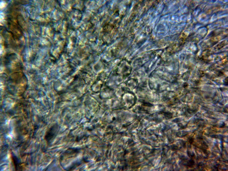 Anthracobia tristis 18 - Excípulo medular